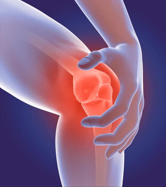 Arthritis Profile