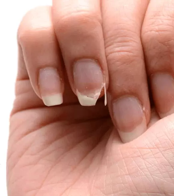 Vitamin Profile