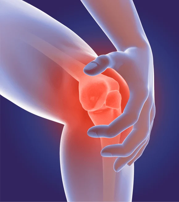 Arthritis Profile